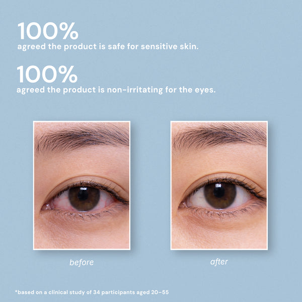 BOTANICAL EYELID CLEANSER